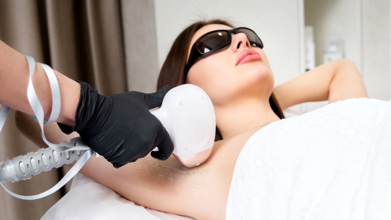 Laser hair removal underarm