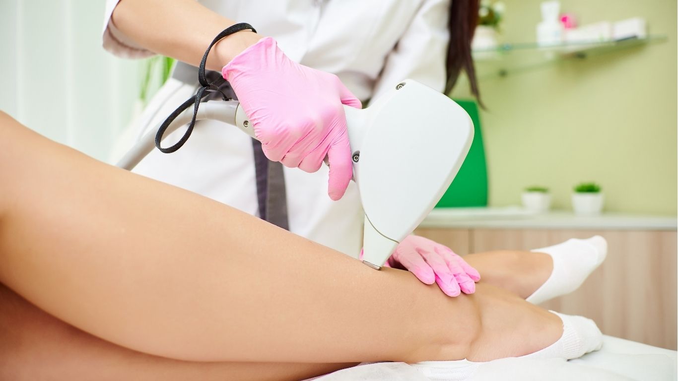 Laser hair removal